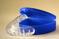 retainers 2