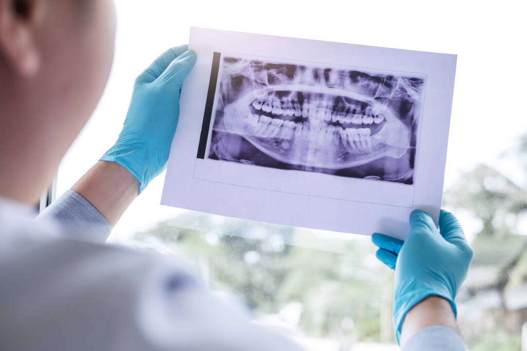 Male doctor or dentist holding an X-ray image of teeth while wearing blue gloves, examining dental health.