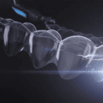 High Definition Invisalign Image