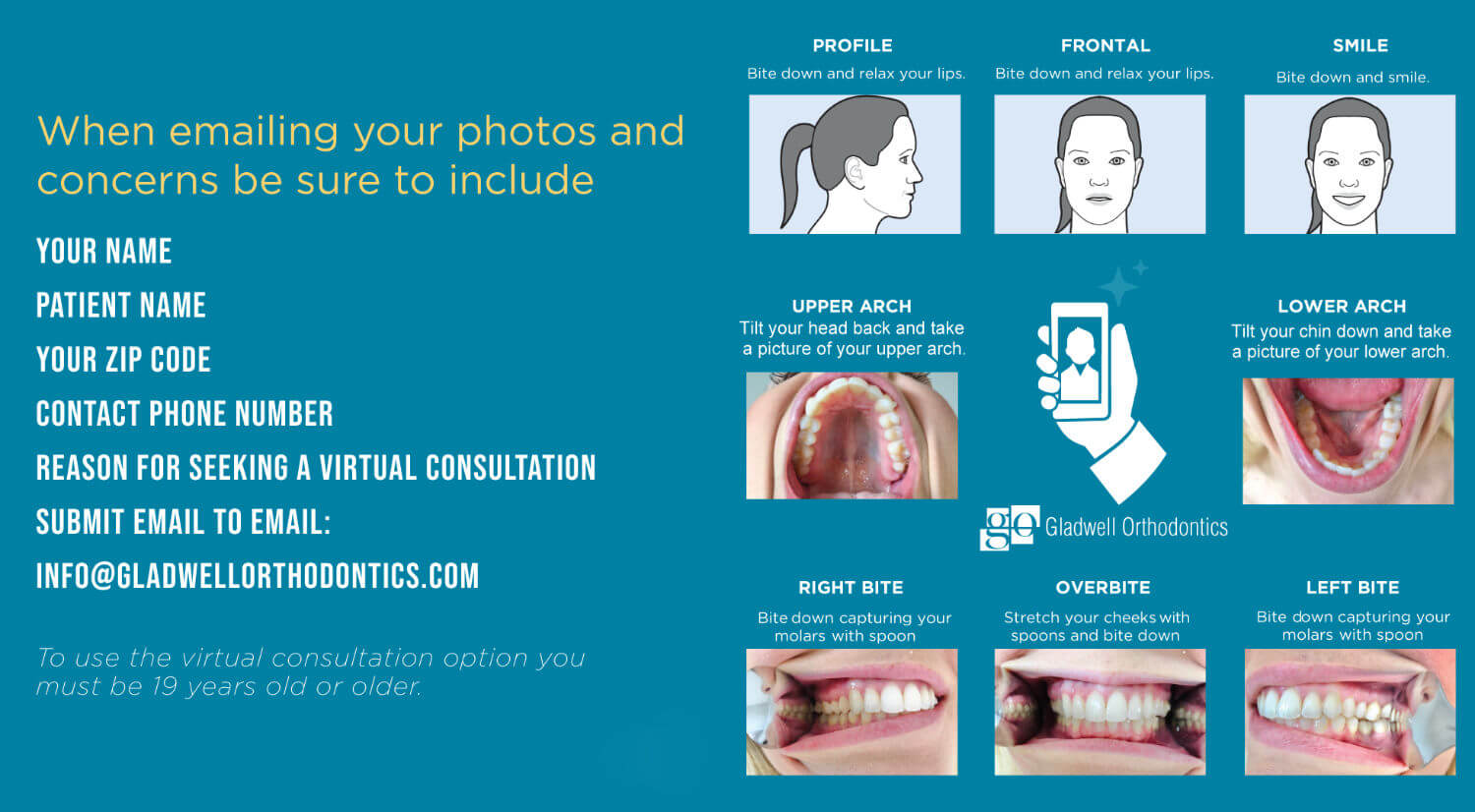 Gladwell Orthodontics - How to Guide for Invisalign Virtual Consultation