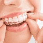 Invisalign In Durham, NC