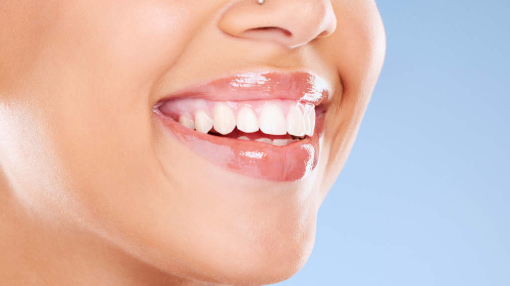 Teeth Whitening And Straightening