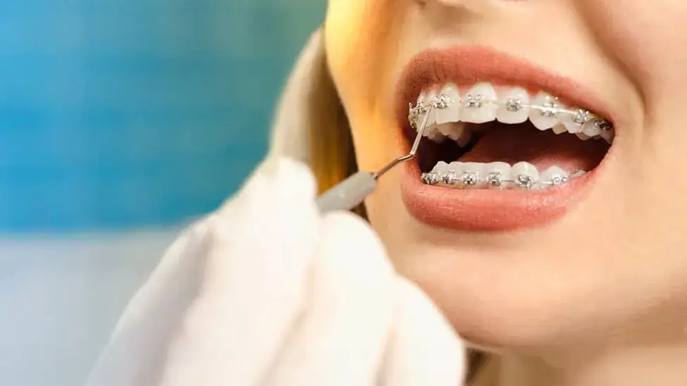 braces in Raleigh, NC