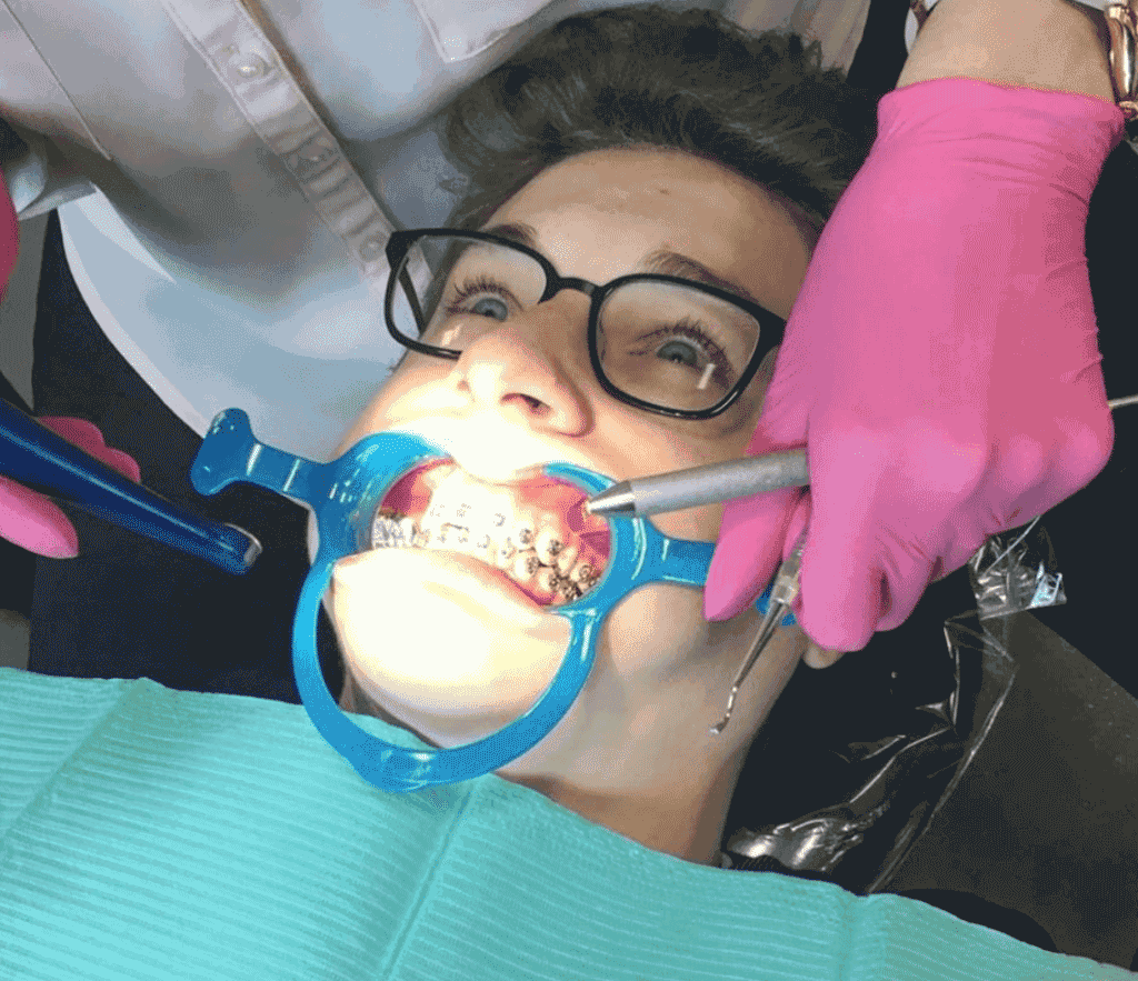 Braces in Raleigh, NC 1 Screen-Shot-2020-05-01-at-8.29