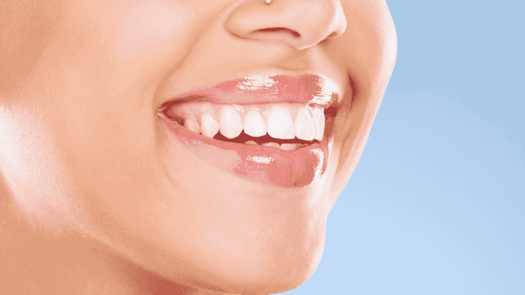 Teeth-Whitening-And-Straightening