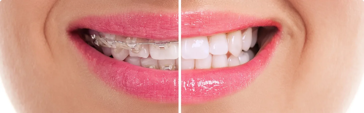 “Affordable Orthodontics” Hub 5 5